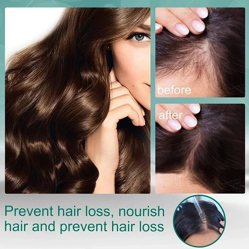 Cairan perawatan empat herbal, - Hair Care Natural Ingredients ulasan dan harga