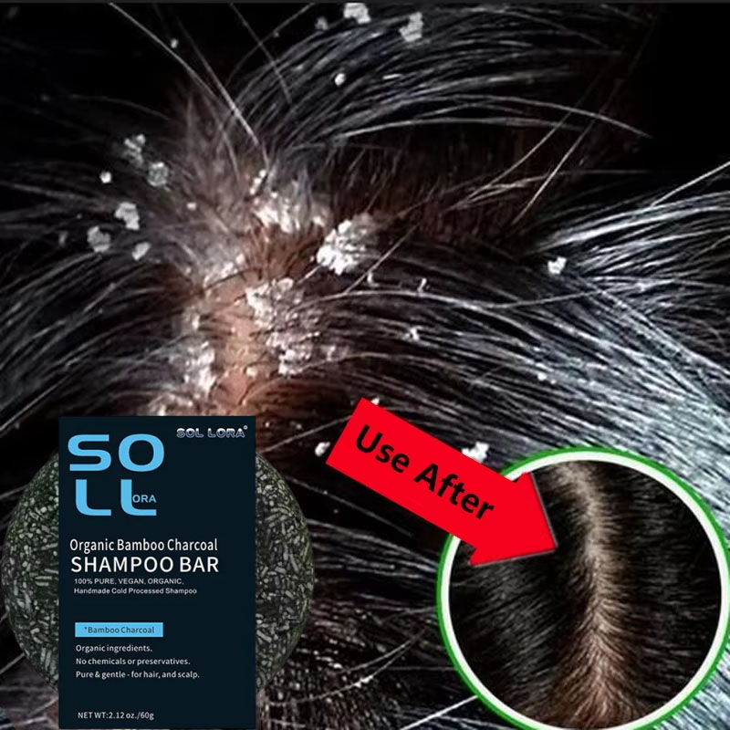 Sabun Perawatan Rambut Anti Ke - Hair Care Dandruff ulasan dan harga
